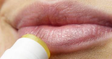 Ultimi sprazzi di sole: come prevenire l´herpes labiale